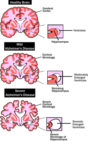 [image: brains]